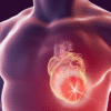 Early Signs of a Heart Attack You Should Never Ignore
