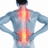 Severe Back Pain