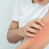 Skin Allergy Treatment in Solapur