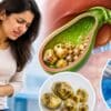 Gallbladder Stone Treatment in Solapur